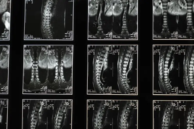 what can a full body mri help assess